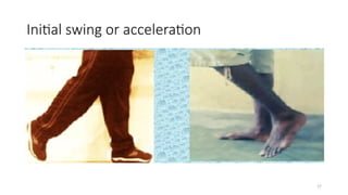 Staggering Motion Stance and gait abnormalities for neurology | PPTX