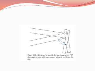 Standard alignment | PPTX