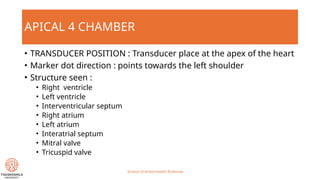 Apical Direction The standard echocardiography windows.pptx