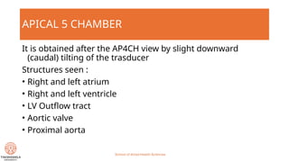 The standard echocardiography windows.pptx
