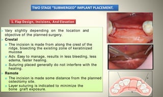 Approximated Incision Healing Ridge Standard implant surgical procedure.pptx