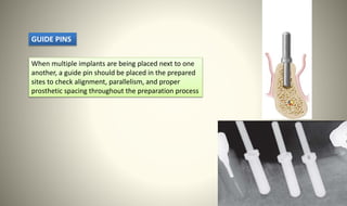 Standard implant surgical procedure.pptx