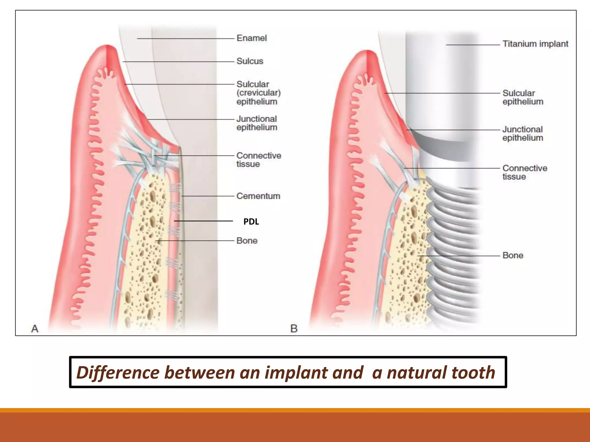 Tooth Im Plan Example Standard implant surgical procedures | PPTX
