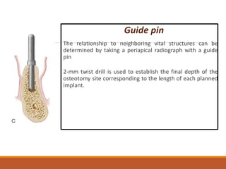 Sharp Surgical Guide Pin Standard implant surgical procedures | PPTX