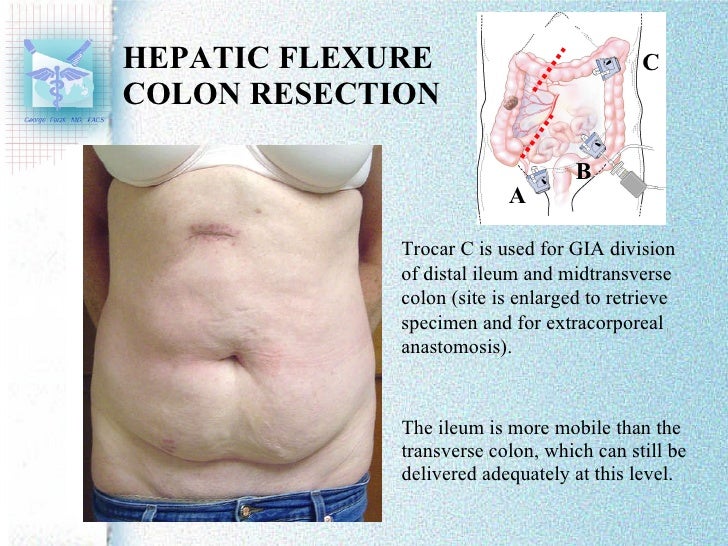 Standardized Placement of Ports