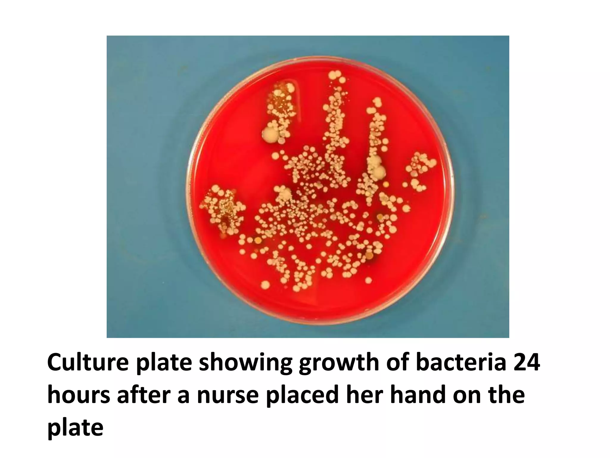 Culture plate showing growth of bacteria 24
hours after a nurse placed her hand on the
plate
 
