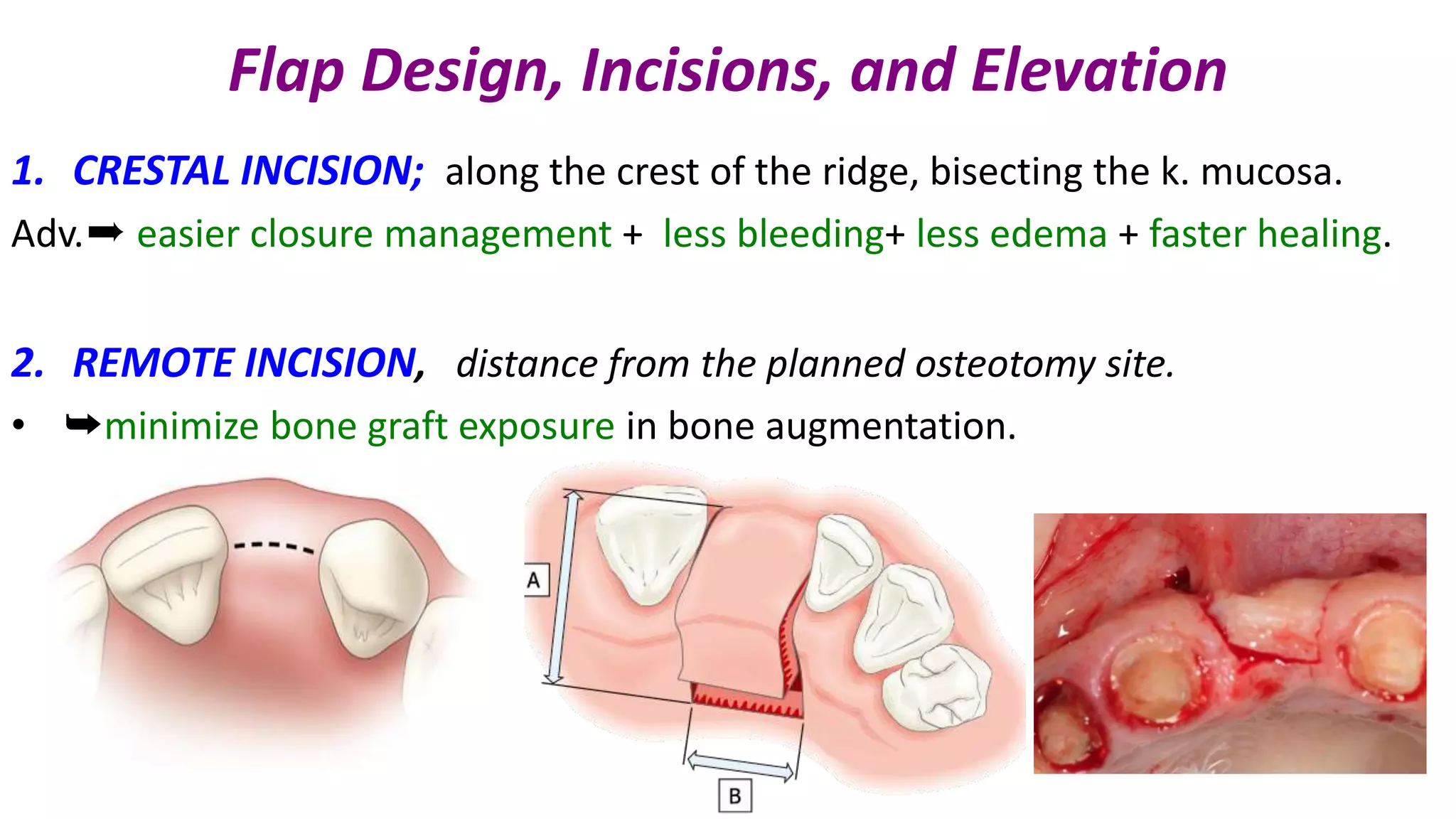 Standard surgical procedure for implant placement | PPTX
