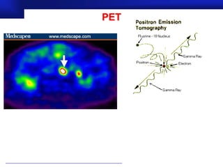 PET




      Prof.Dr. İbrahim USLU
 