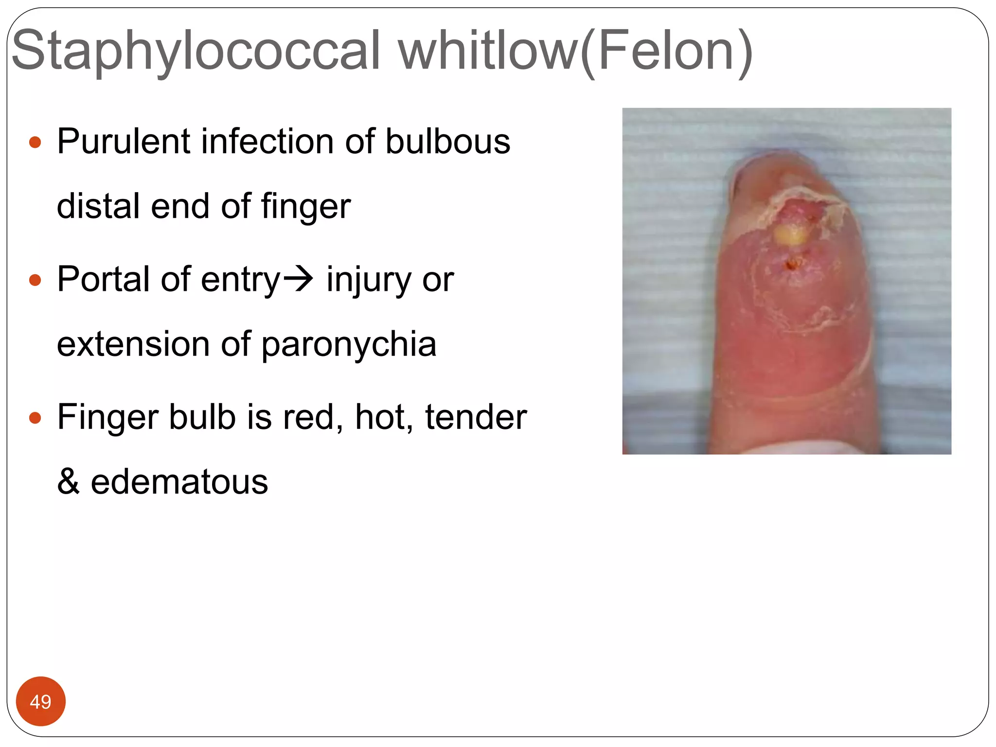 Staphylococcal & streptococcal skin infections | PPTX