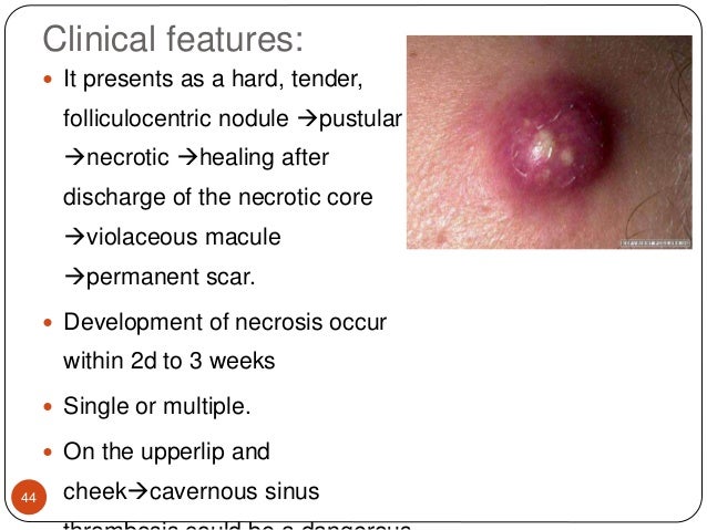 Staphylococcal & streptococcal skin infections Staphylococcal & streptococcal skin infections