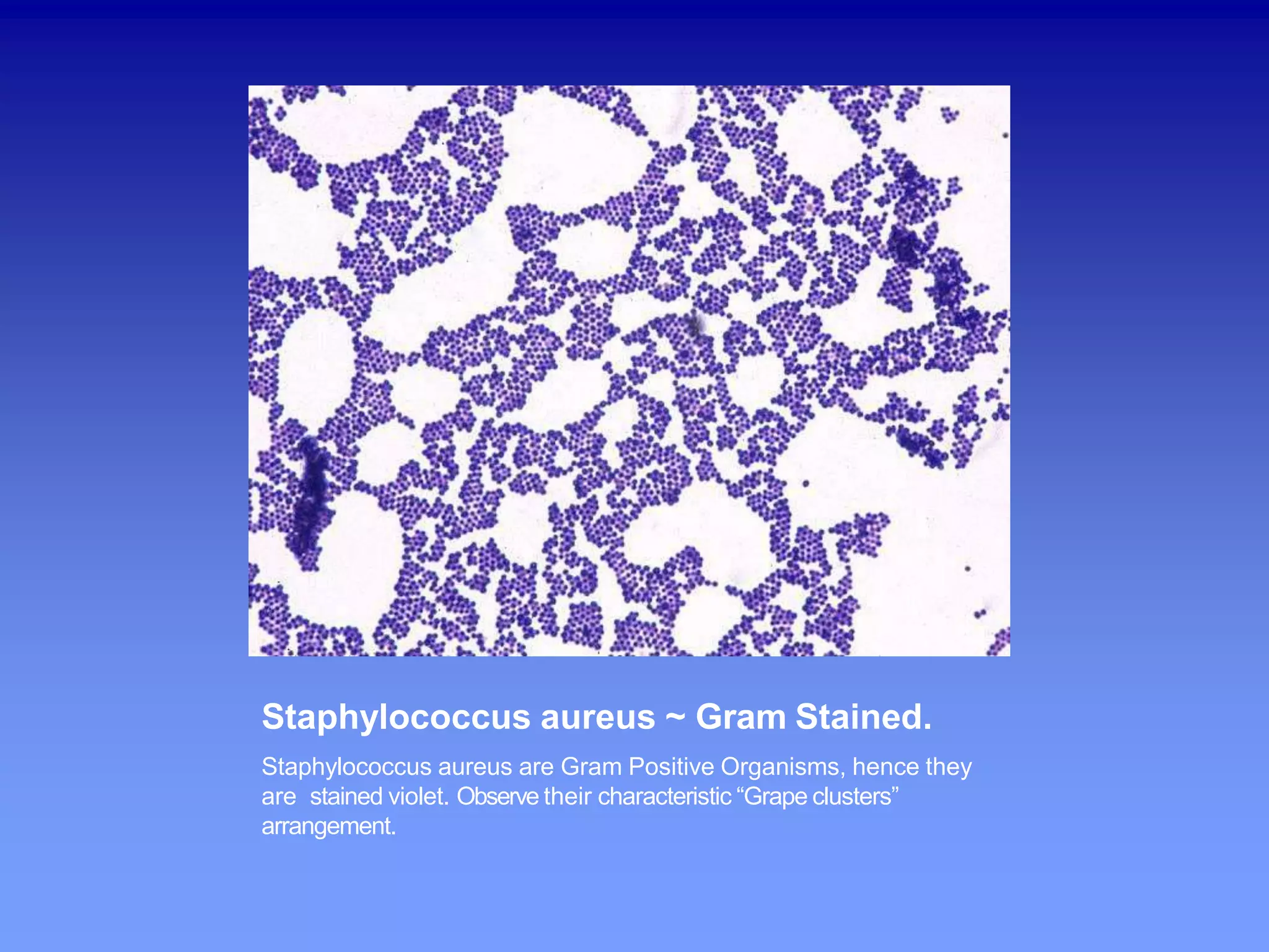 Staph Skin Infectious Staphylococcal skin infections by dr, Hari dagal | PPT