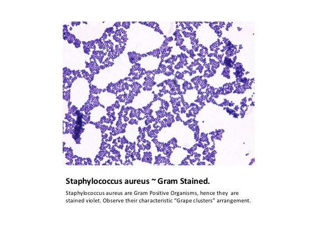 staph aureus gram stain major magdalene project org staph aureus gram stain
