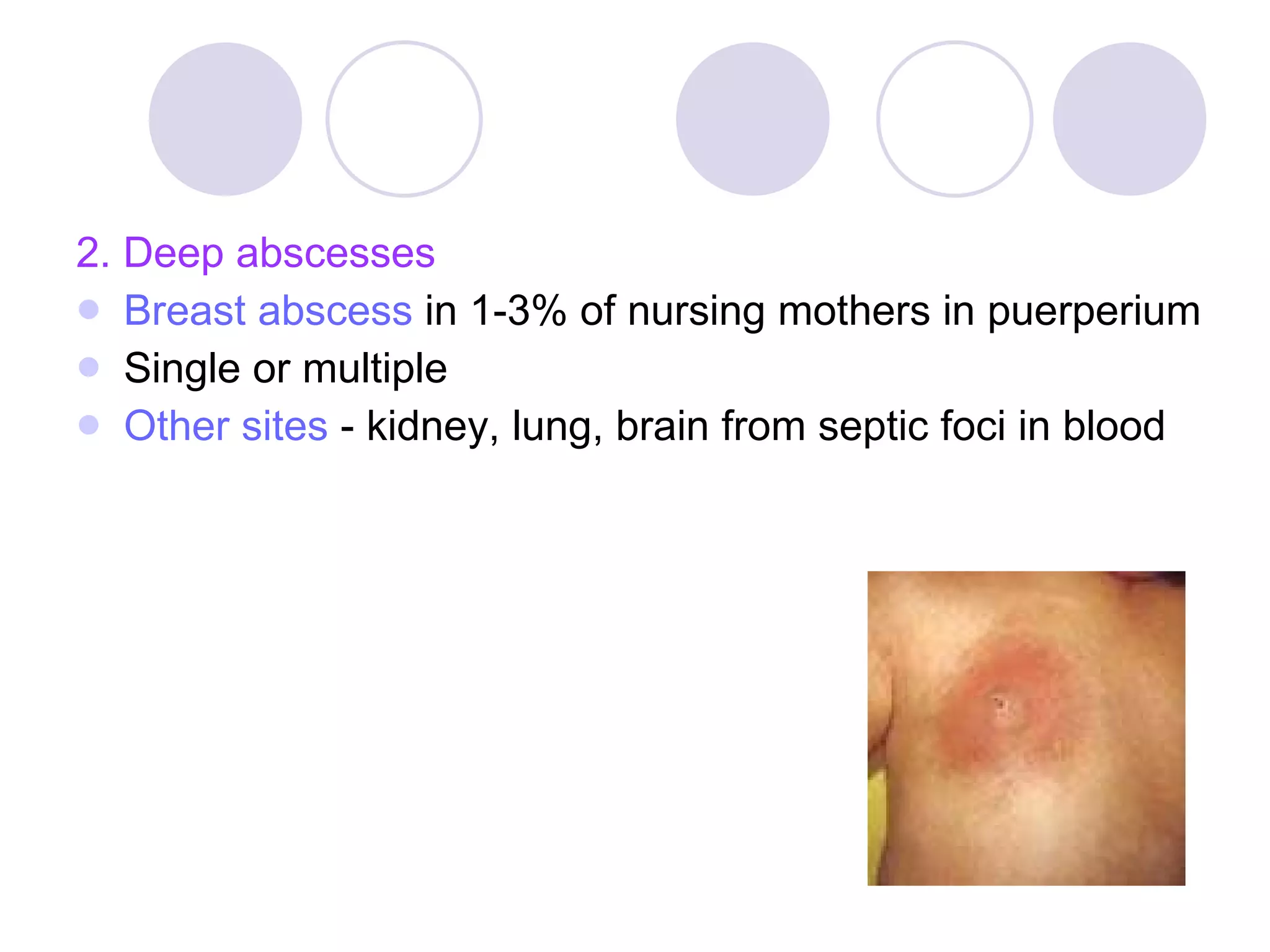 2. Deep abscesses Breast abscess  in 1-3% of nursing mothers in puerperium Single or multiple Other sites  - kidney, lung, brain from septic foci in blood 