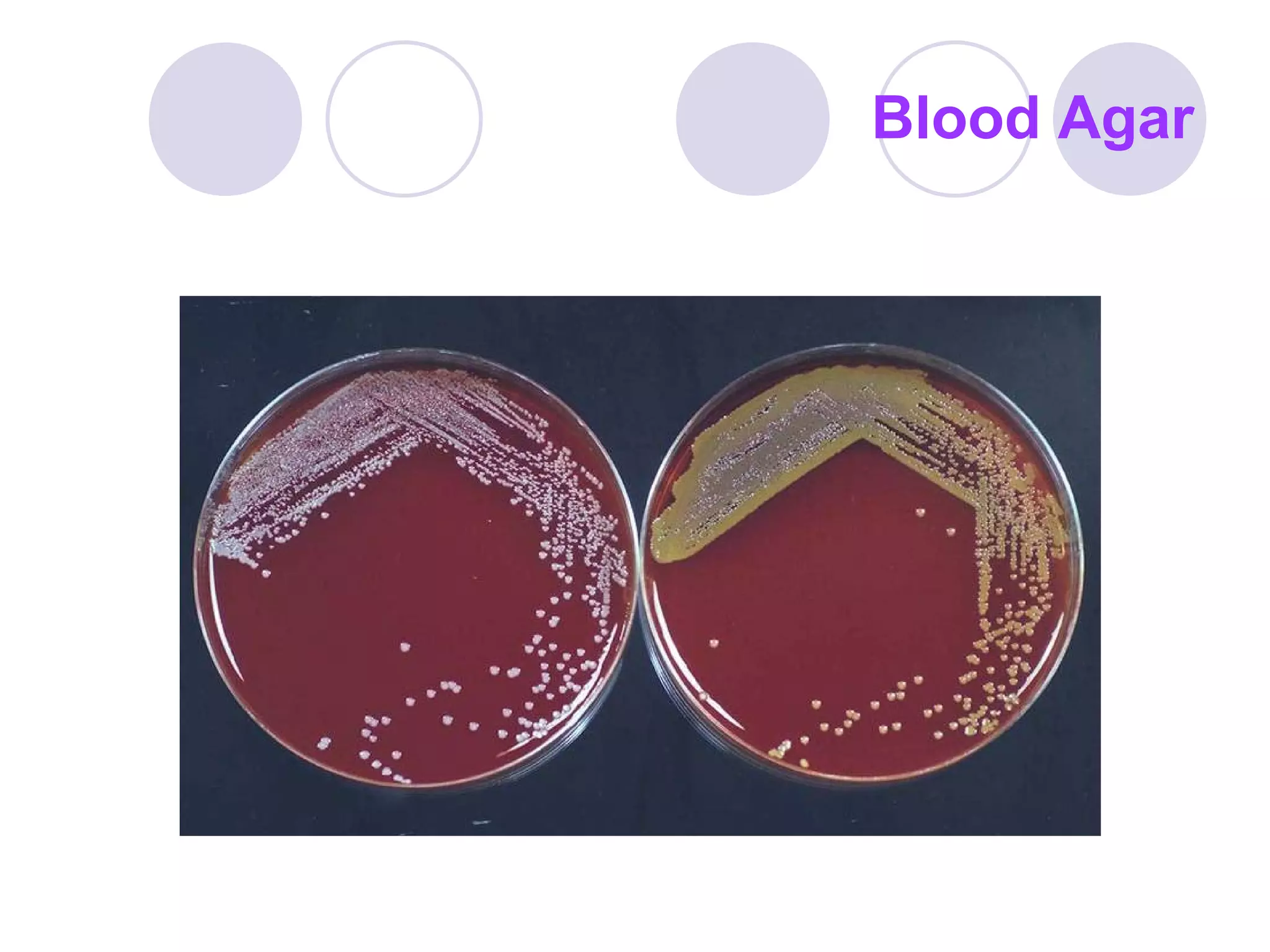 Blood Agar 