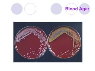 Blood Agar 