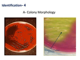 Identification- 4
A- Colony Morphology

 