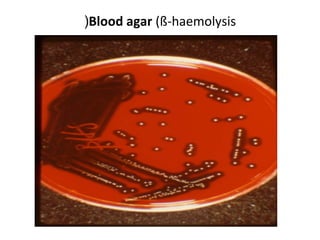 (Blood agar (ß-haemolysis

 
