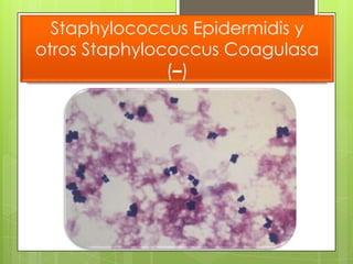 Staphylococcus Epidermidis y
otros Staphylococcus Coagulasa
               (–)
 