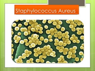 Staphylococcus Aureus
 