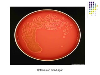 Colonies on biood agar
 
