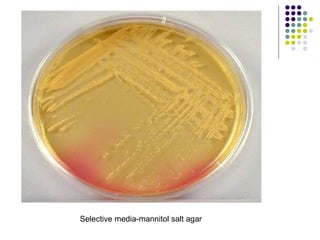 Selective media-mannitol salt agar
 