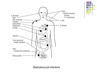 Staphylococcal infections
 