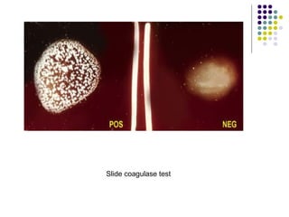 Slide coagulase test
 