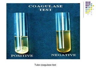 Tube coagulase test
 