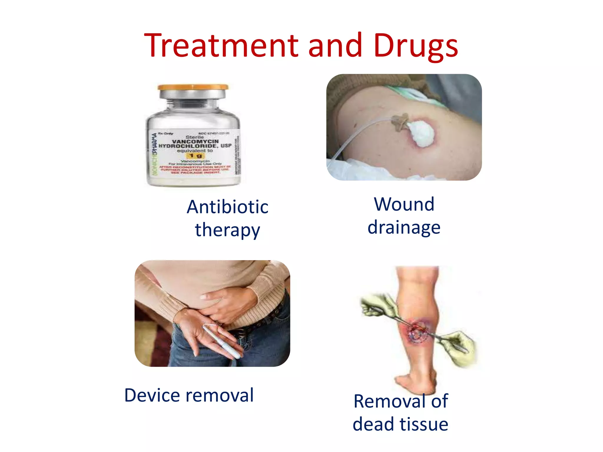 Treatment and Drugs
Antibiotic
therapy
Wound
drainage
Device removal Removal of
dead tissue
 