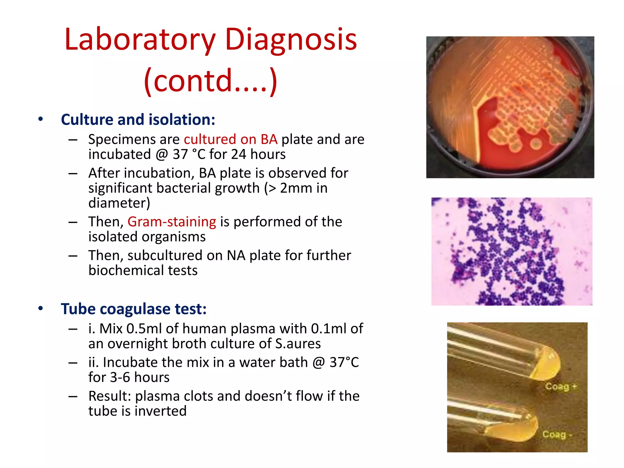 Laboratory Diagnosis
(contd....)
• Culture and isolation:
– Specimens are cultured on BA plate and are
incubated @ 37 °C for 24 hours
– After incubation, BA plate is observed for
significant bacterial growth (> 2mm in
diameter)
– Then, Gram-staining is performed of the
isolated organisms
– Then, subcultured on NA plate for further
biochemical tests
• Tube coagulase test:
– i. Mix 0.5ml of human plasma with 0.1ml of
an overnight broth culture of S.aures
– ii. Incubate the mix in a water bath @ 37°C
for 3-6 hours
– Result: plasma clots and doesn’t flow if the
tube is inverted
 