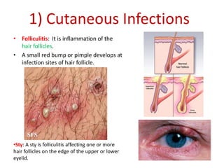 Staphylococcus | PPTX