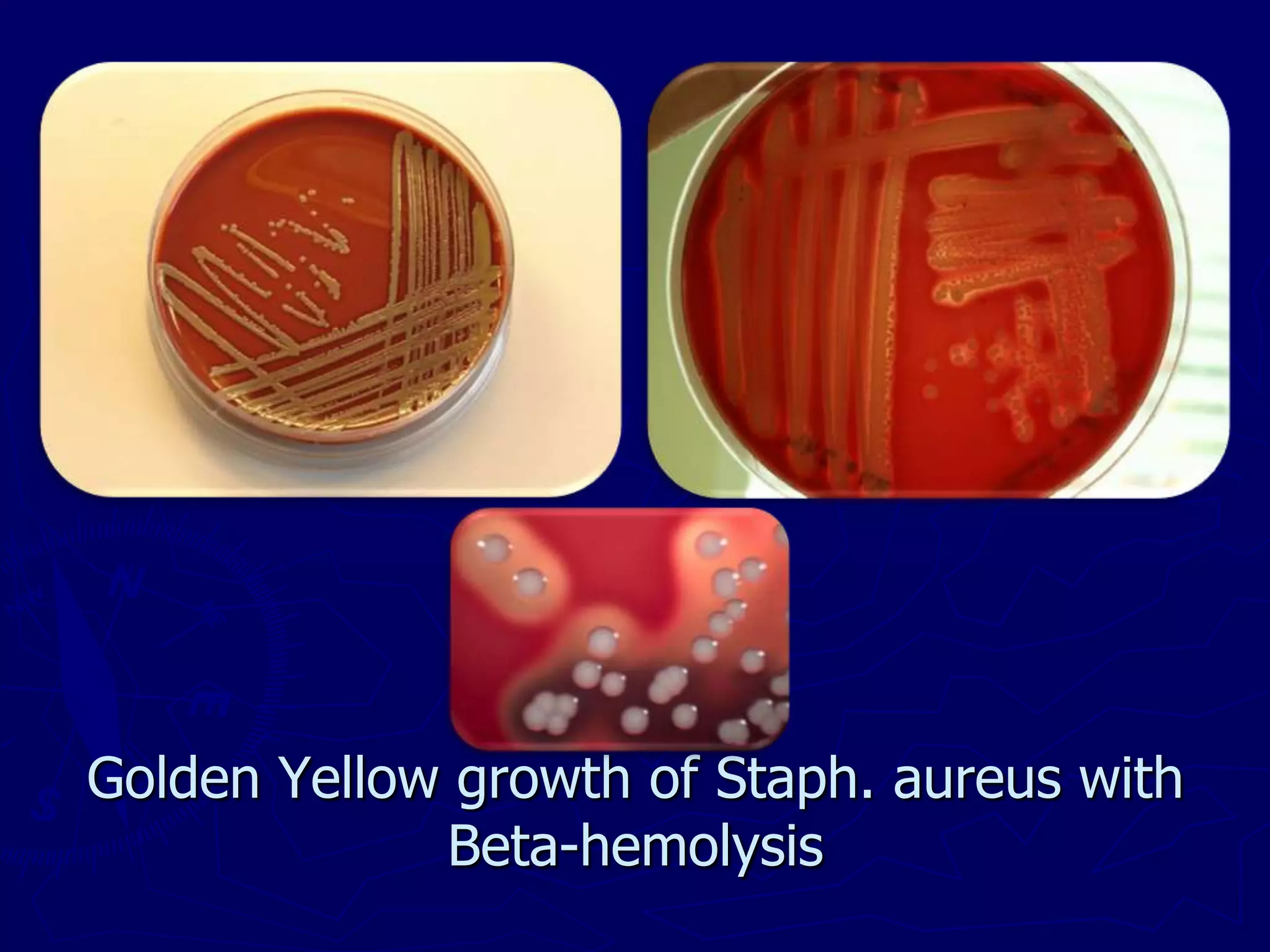 Golden Yellow growth of Staph. aureus with
Beta-hemolysis
 