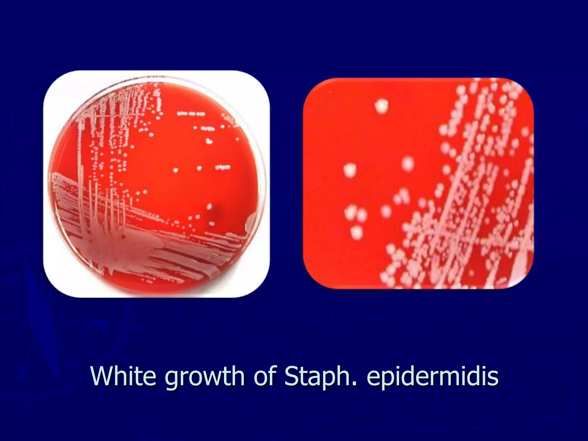 White growth of Staph. epidermidis
 
