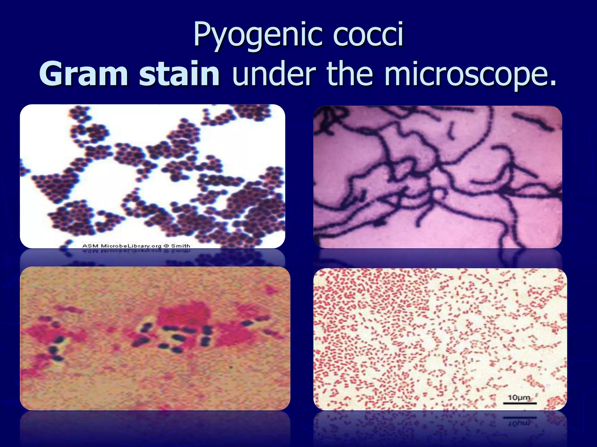 Pyogenic cocci
Gram stain under the microscope.
 