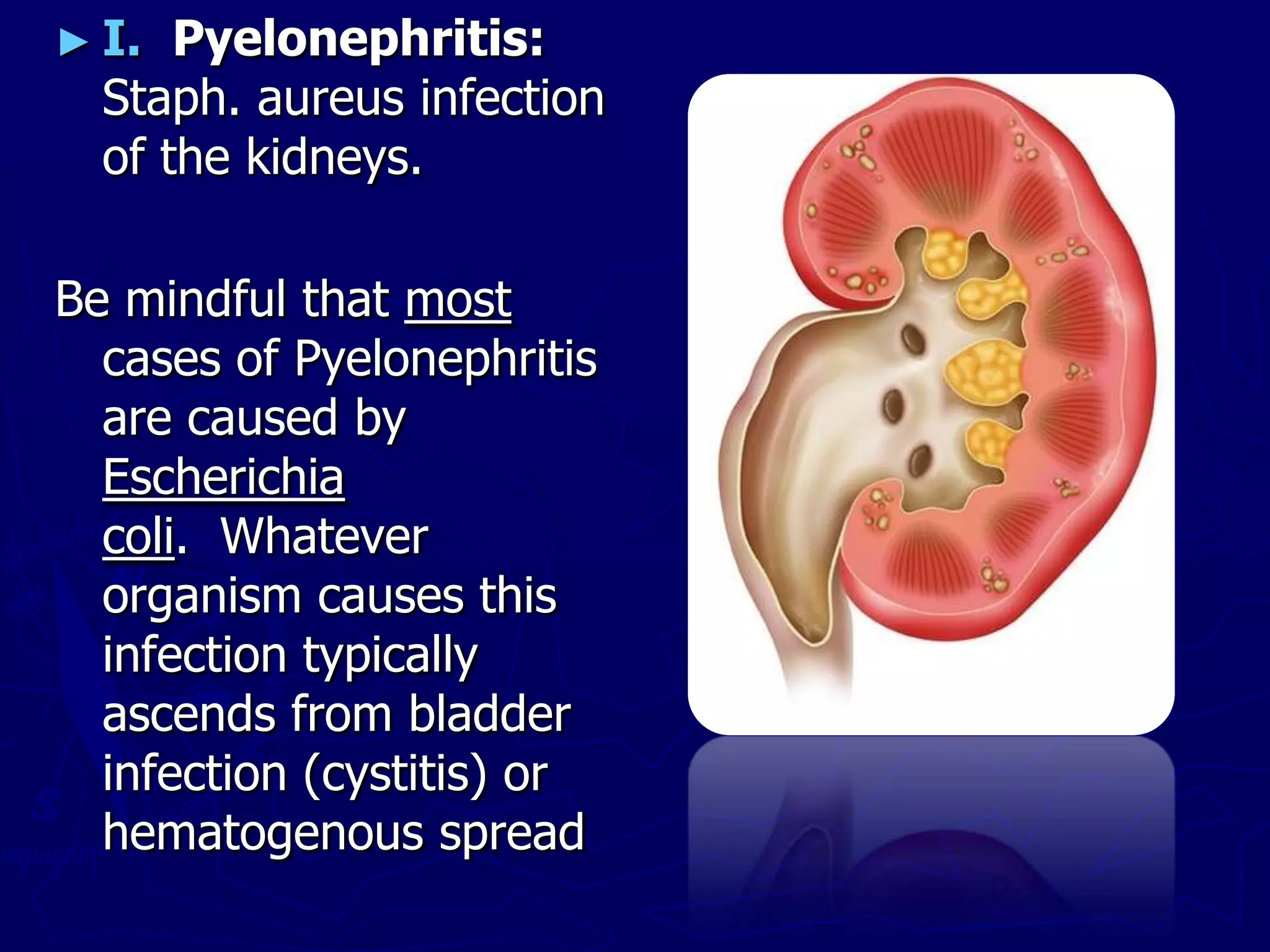 ► I. Pyelonephritis:
Staph. aureus infection
of the kidneys.
Be mindful that most
cases of Pyelonephritis
are caused by
Escherichia
coli. Whatever
organism causes this
infection typically
ascends from bladder
infection (cystitis) or
hematogenous spread
 