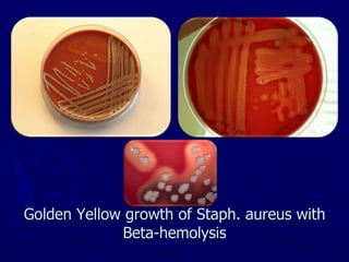 Golden Yellow growth of Staph. aureus with
Beta-hemolysis
 
