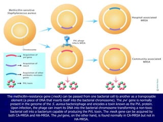 The methicillin-resistance gene (mecA) can be passed from one bacterial cell to another as a transposable
element (a piece of DNA that inserts itself into the bacterial chromosome). The pvl gene is normally
present in the genome of the S. aureus bacteriophage and encodes a toxin known as the PVL protein.
Upon infection, the phage can insert its DNA into the bacterial chromosome transforming a non-toxic
bacterial cell into a bacterium capable of producing the PVL toxin. The mecA gene can be acquired by
both CA-MRSA and HA-MRSA. The pvl gene, on the other hand, is found normally in CA-MRSA but not in
HA-MRSA.
 