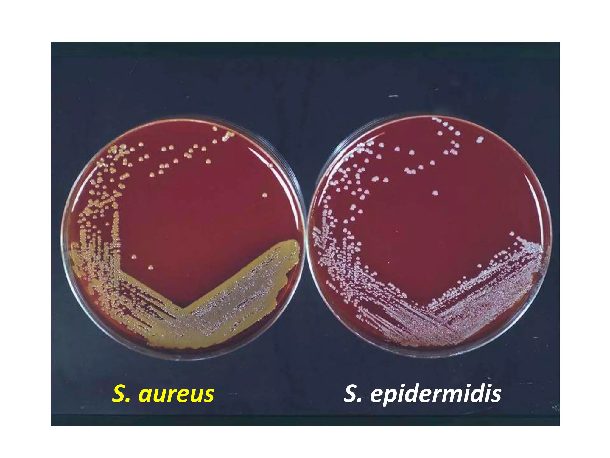 S. aureus S. epidermidis
 