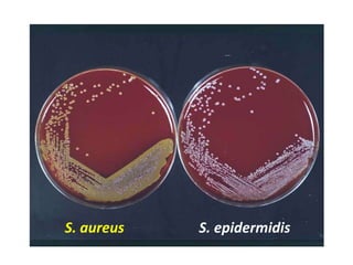 S. aureus S. epidermidis
 