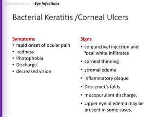 Bacterial Keratitis /Corneal Ulcers
Symptoms
• rapid onset of ocular pain
• redness
• Photophobia
• Discharge
• decreased vision
Signs
• conjunctival injection and
focal white infiltrates
• corneal thinning
• stromal edema
• inflammatory plaque
• Descemet’s folds
• mucopurulent discharge,
• Upper eyelid edema may be
present in some cases.
Staphylococcus – Eye Infections
 