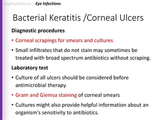 Bacterial Keratitis /Corneal Ulcers
Diagnostic procedures
• Corneal scrapings for smears and cultures
• Small infiltrates that do not stain may sometimes be
treated with broad spectrum antibiotics without scraping.
Laboratory test
• Culture of all ulcers should be considered before
antimicrobial therapy.
• Gram and Giemsa staining of corneal smears
• Cultures might also provide helpful information about an
organism's sensitivity to antibiotics.
Staphylococcus – Eye Infections
 