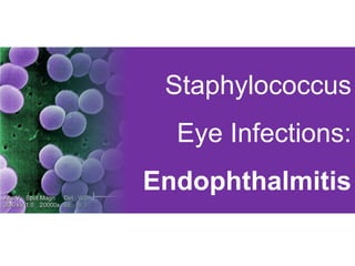 Staphylococcus
Eye Infections:
Endophthalmitis
 