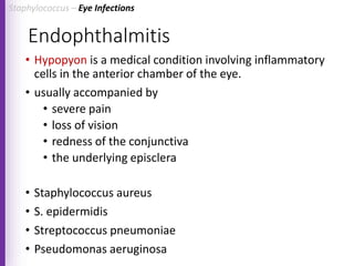 Endophthalmitis
• Hypopyon is a medical condition involving inflammatory
cells in the anterior chamber of the eye.
• usually accompanied by
• severe pain
• loss of vision
• redness of the conjunctiva
• the underlying episclera
• Staphylococcus aureus
• S. epidermidis
• Streptococcus pneumoniae
• Pseudomonas aeruginosa
Staphylococcus – Eye Infections
 