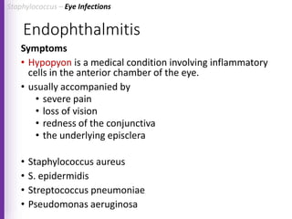 Endophthalmitis
Symptoms
• Hypopyon is a medical condition involving inflammatory
cells in the anterior chamber of the eye.
• usually accompanied by
• severe pain
• loss of vision
• redness of the conjunctiva
• the underlying episclera
• Staphylococcus aureus
• S. epidermidis
• Streptococcus pneumoniae
• Pseudomonas aeruginosa
Staphylococcus – Eye Infections
 