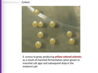S. aureus to grow, producing yellow-colored colonies
as a result of mannitol fermentation when grown in
mannitol salt agar and subsequent drop in the
medium's pH
Staphylococcus – Culture
 