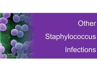 Other
Staphylococcus
Infections
 