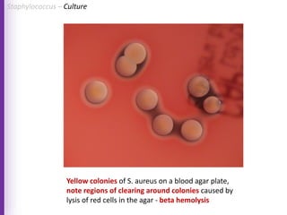 Yellow colonies of S. aureus on a blood agar plate,
note regions of clearing around colonies caused by
lysis of red cells in the agar - beta hemolysis
Staphylococcus – Culture
 