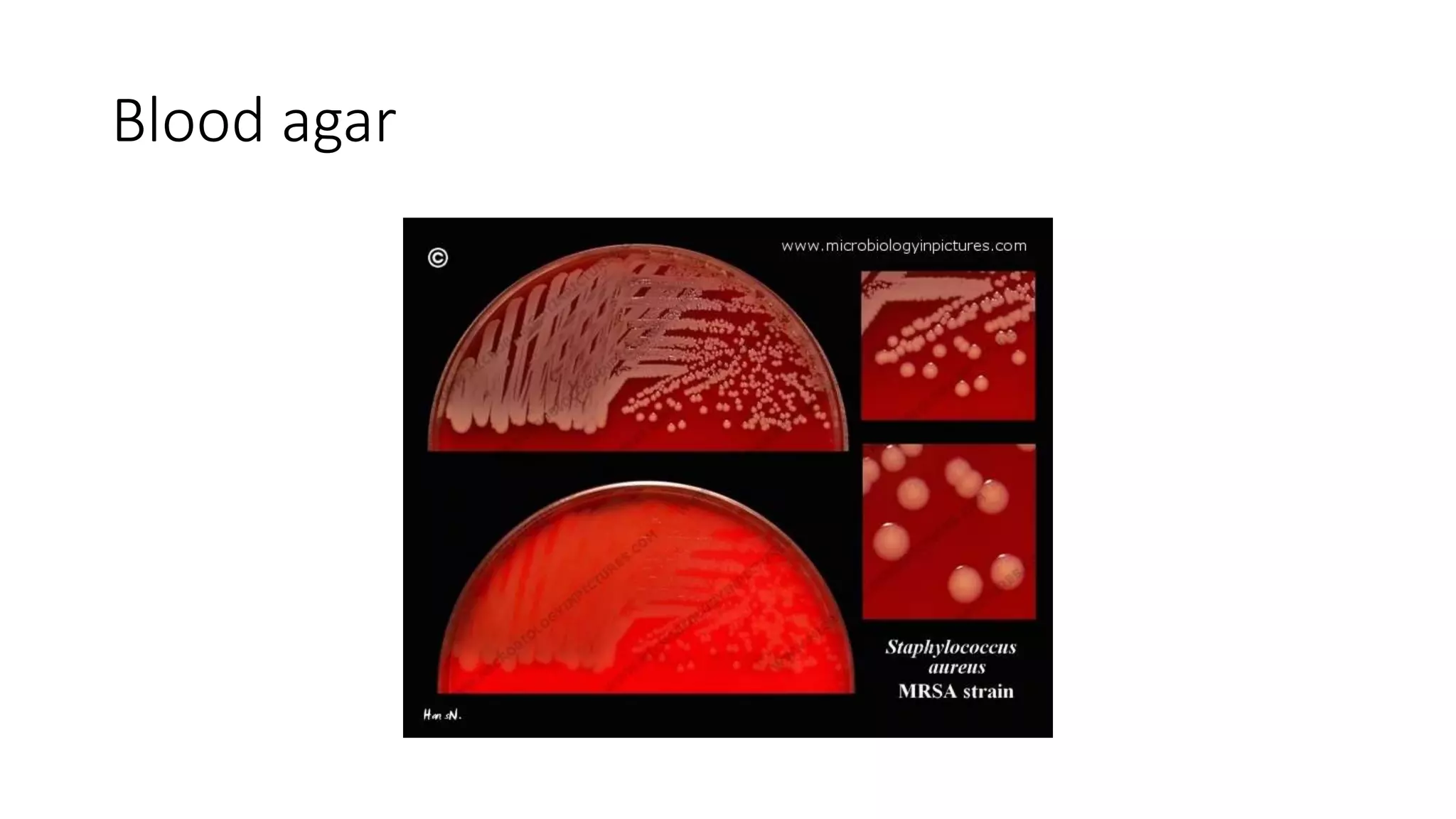 Blood agar
 