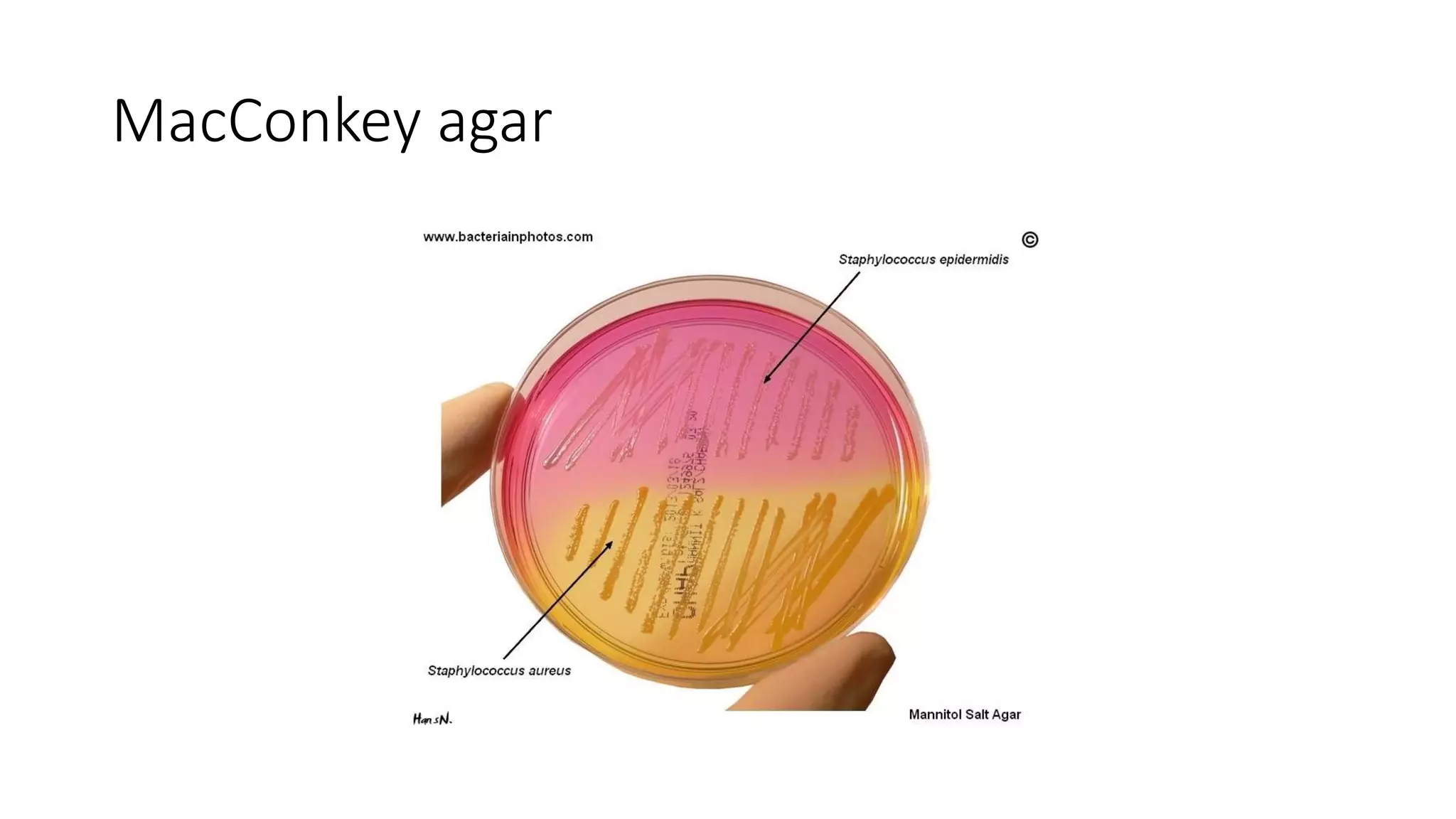 MacConkey agar
 