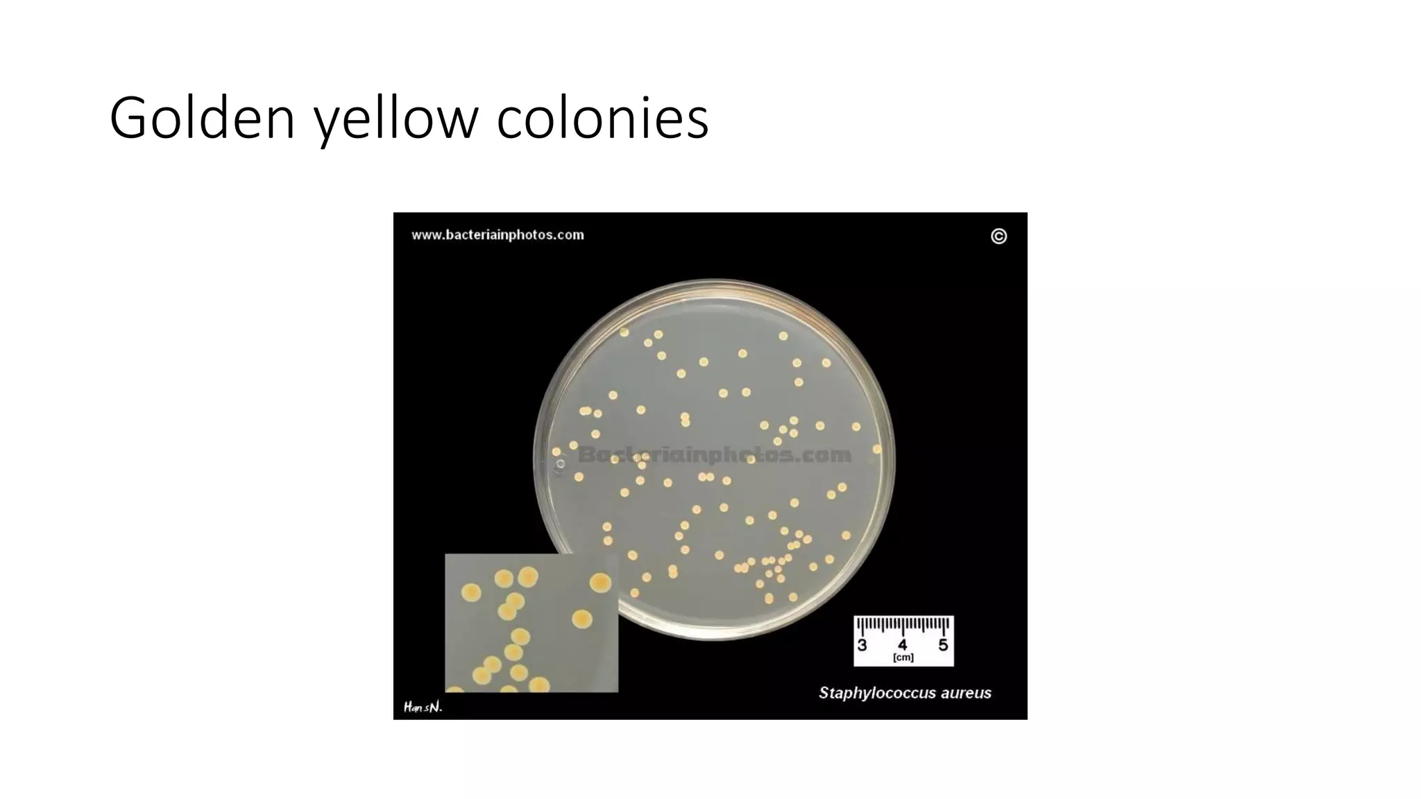 Golden yellow colonies
 